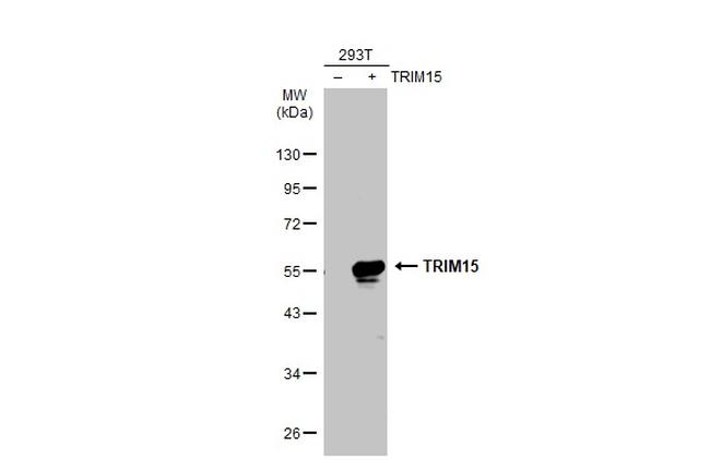 TRIM15 Antibody in Western Blot (WB)