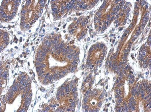 DEPDC7 Antibody in Immunohistochemistry (Paraffin) (IHC (P))