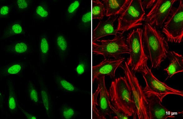 HOXC10 Antibody in Immunocytochemistry (ICC/IF)