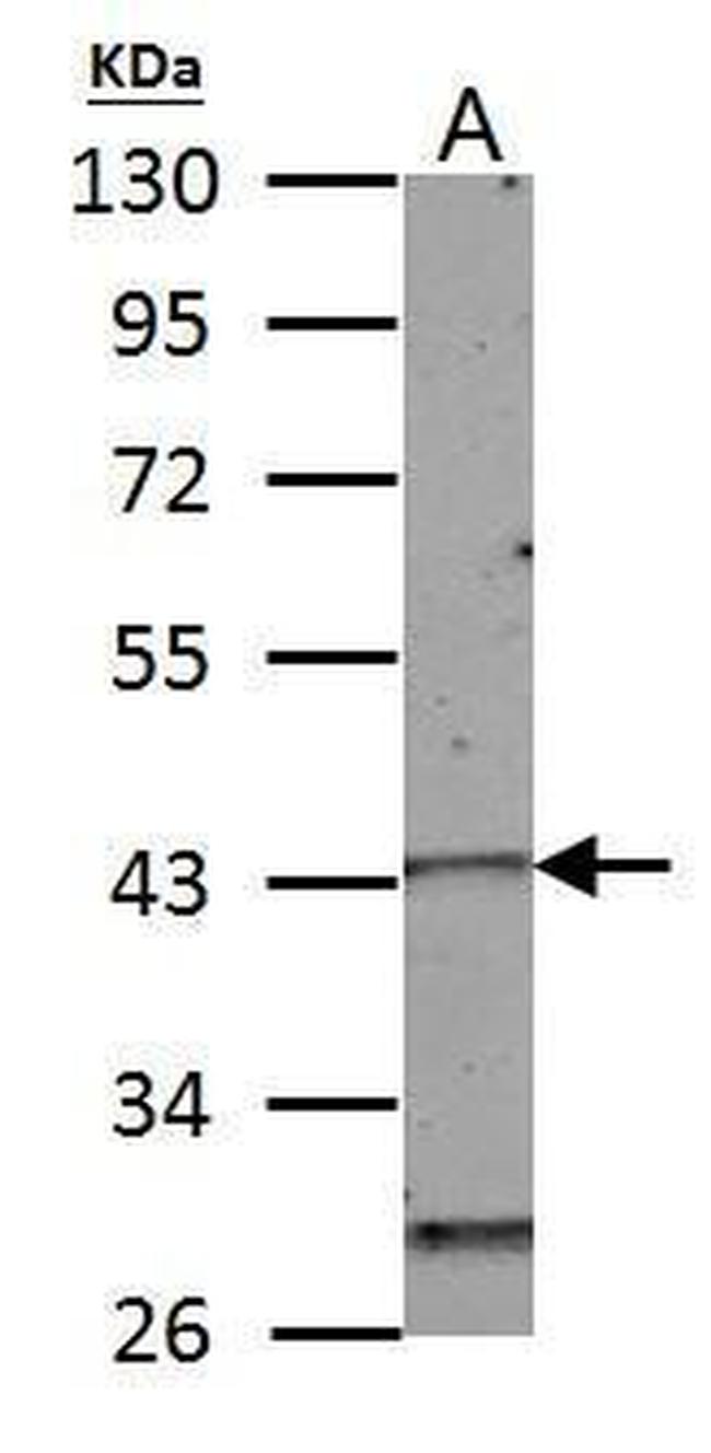 HOXC10 Antibody in Western Blot (WB)