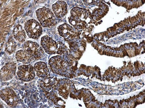 Arginase 2 Antibody in Immunohistochemistry (Paraffin) (IHC (P))