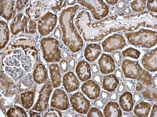 Arginase 2 Antibody in Immunohistochemistry (Paraffin) (IHC (P))