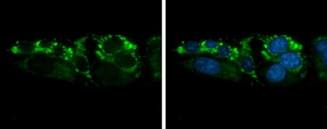 Arginase 2 Antibody in Immunocytochemistry (ICC/IF)