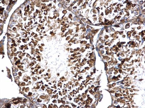 DCP2 Antibody in Immunohistochemistry (Paraffin) (IHC (P))