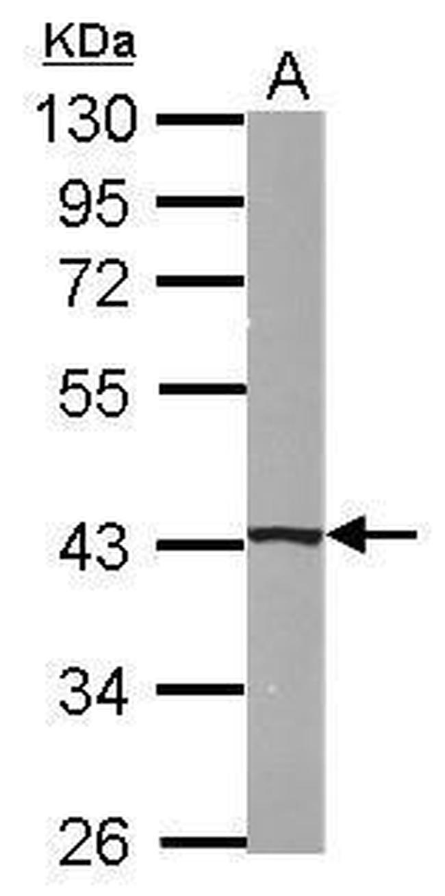 B4GALT5 Antibody in Western Blot (WB)