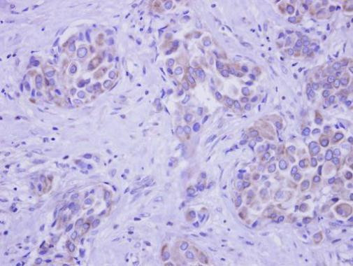 GALNT2 Antibody in Immunohistochemistry (Paraffin) (IHC (P))