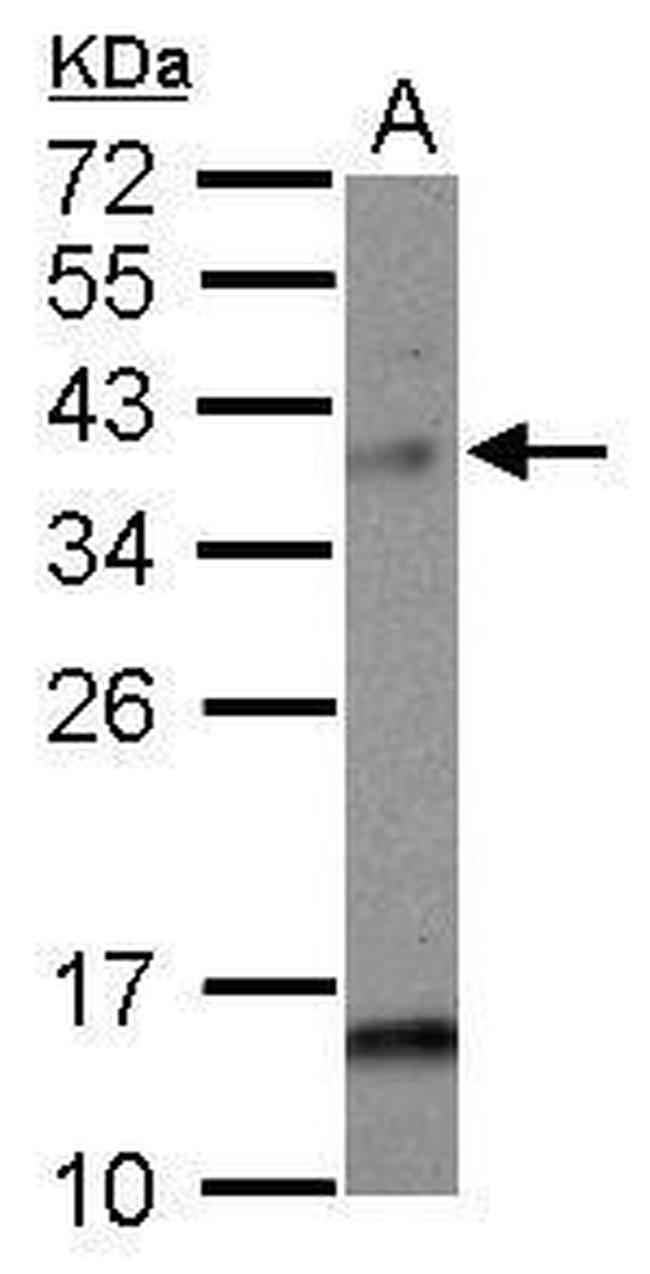 MAD2L1BP Antibody in Western Blot (WB)
