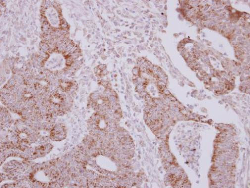 NARS2 Antibody in Immunohistochemistry (Paraffin) (IHC (P))