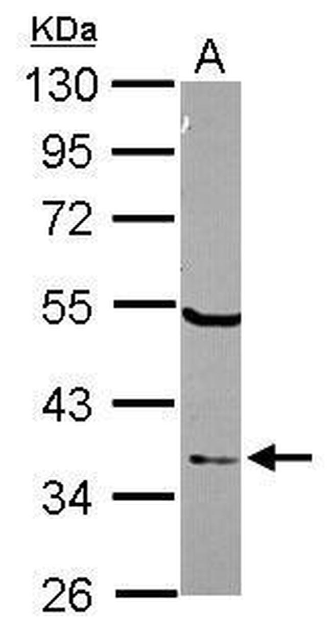 ELAC1 Antibody in Western Blot (WB)