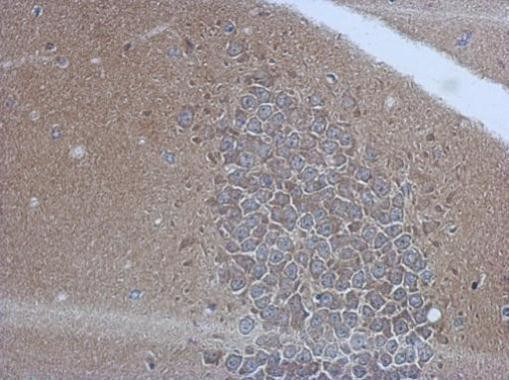 CD226 Antibody in Immunohistochemistry (Paraffin) (IHC (P))