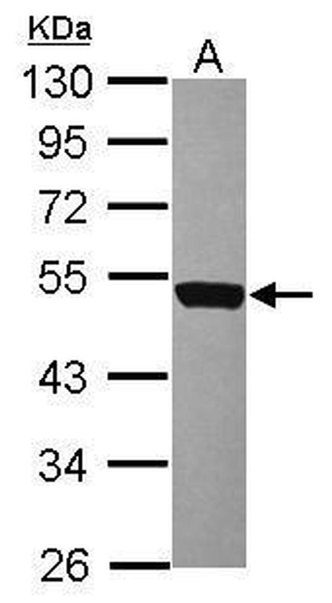 CD226 Antibody in Western Blot (WB)