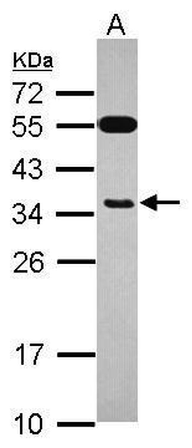 EXOSC8 Antibody in Western Blot (WB)