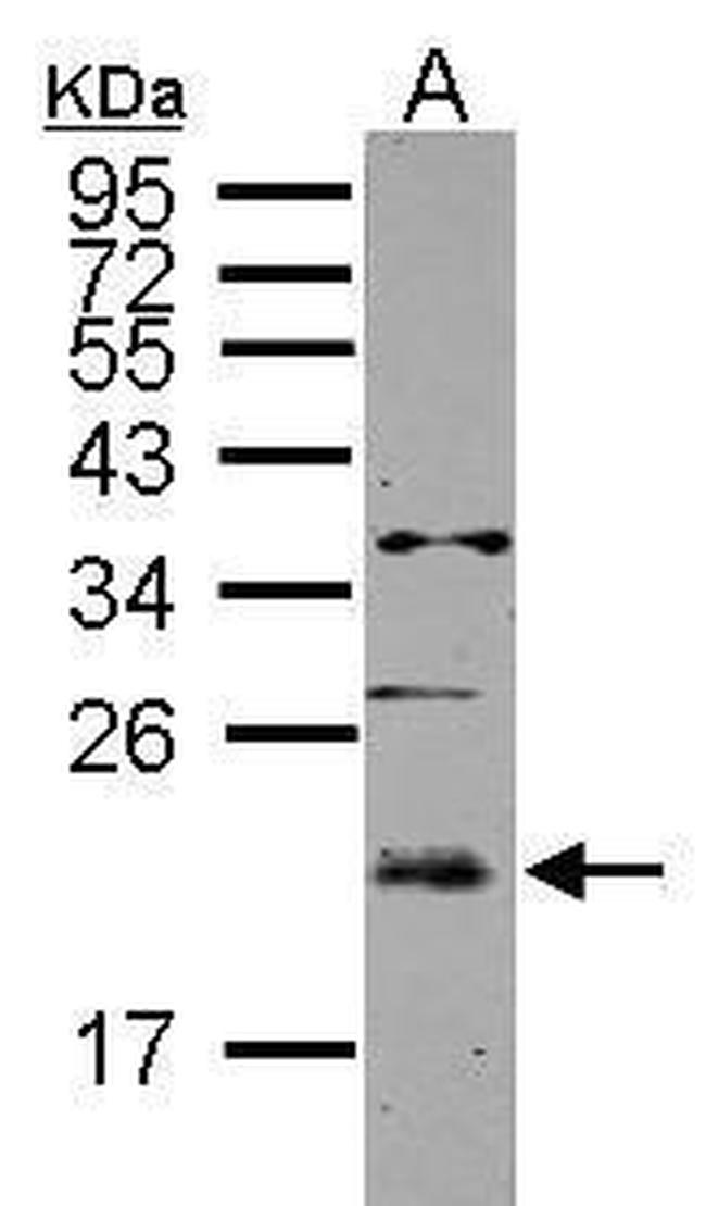 UBE2E3 Antibody in Western Blot (WB)