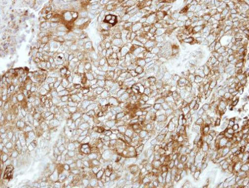 PCDHB16 Antibody in Immunohistochemistry (Paraffin) (IHC (P))