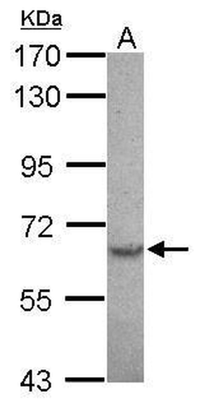 SPTLC2 Antibody in Western Blot (WB)