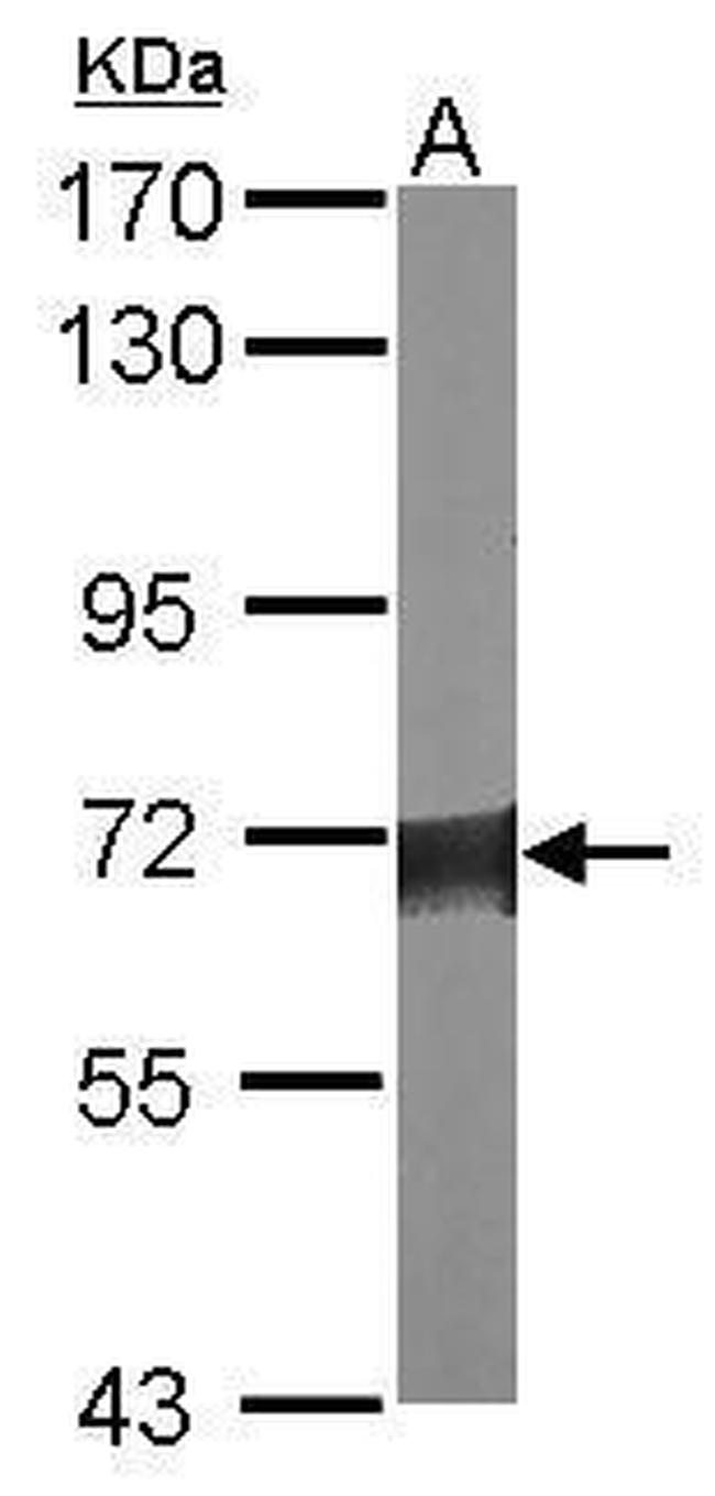 SPTLC2 Antibody in Western Blot (WB)