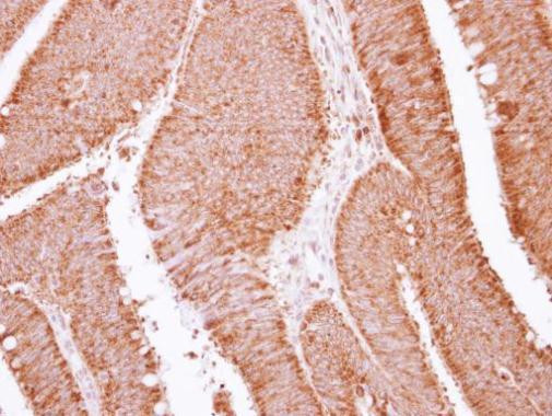 APOBEC3F Antibody in Immunohistochemistry (Paraffin) (IHC (P))