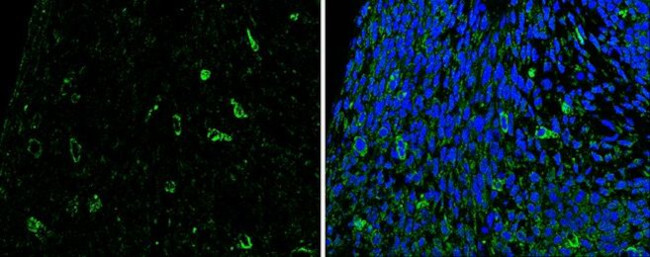 SLIT2 Antibody in Immunohistochemistry (Paraffin) (IHC (P))