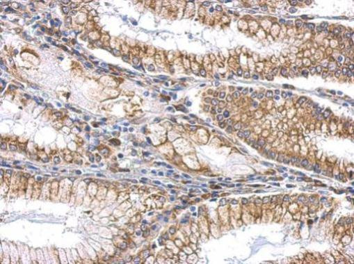 SLIT2 Antibody in Immunohistochemistry (Paraffin) (IHC (P))