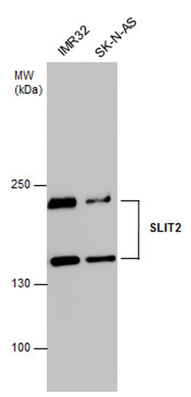 SLIT2 Antibody in Western Blot (WB)