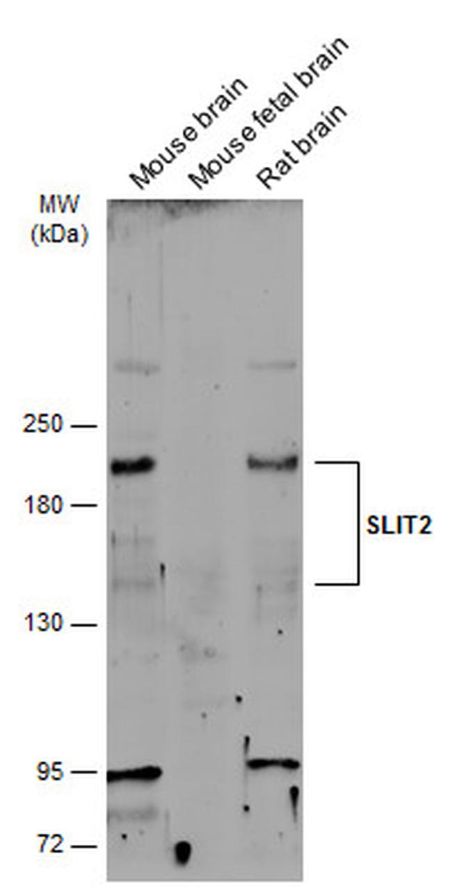 SLIT2 Antibody in Western Blot (WB)