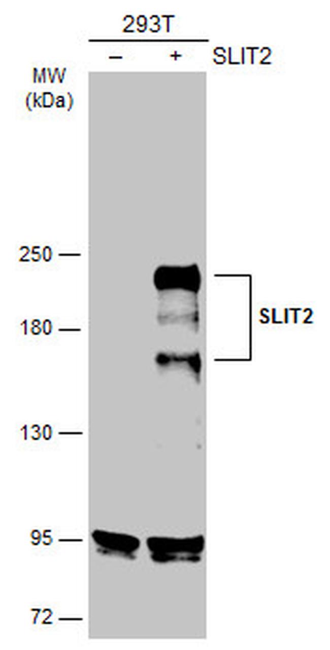 SLIT2 Antibody in Western Blot (WB)