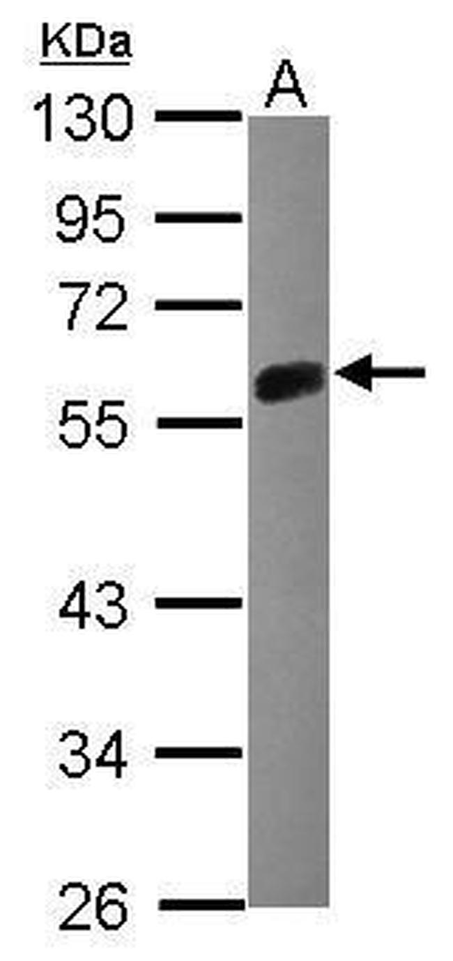 Mig-6 Antibody in Western Blot (WB)