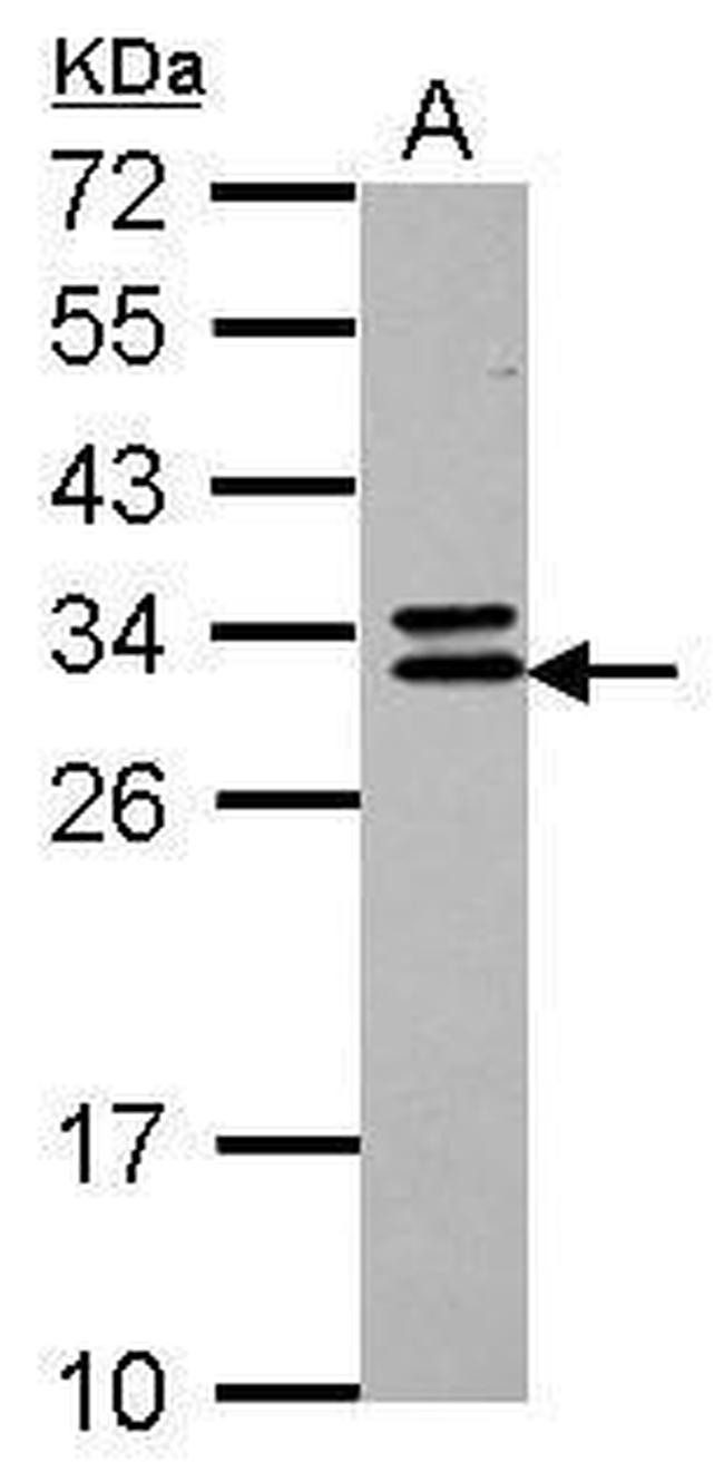 CNOT7 Antibody in Western Blot (WB)