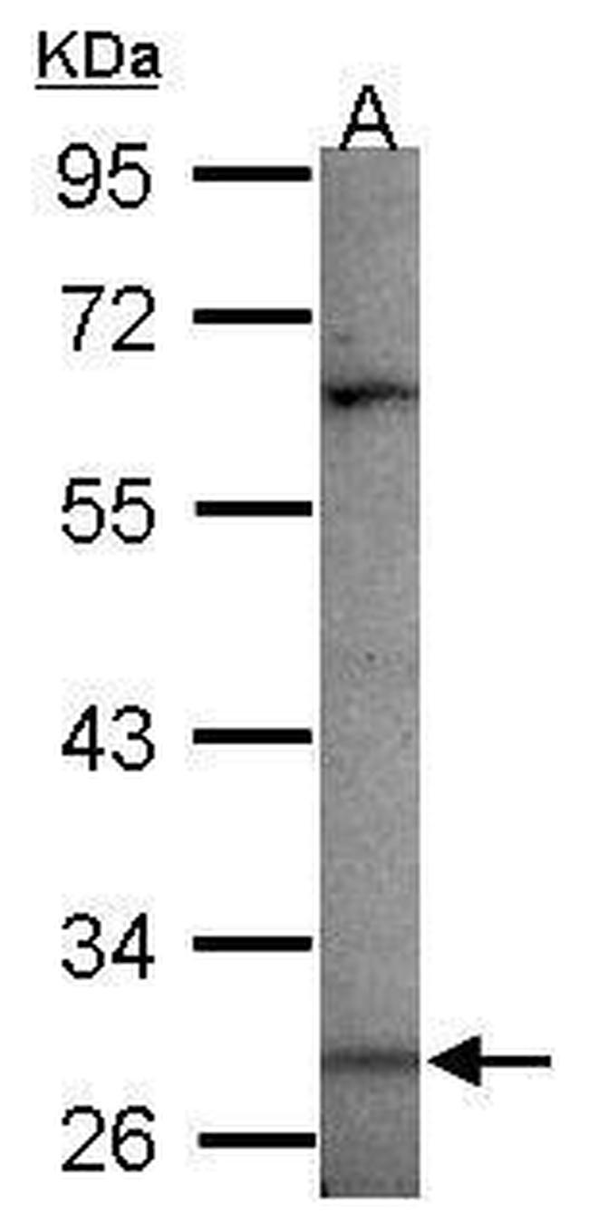 MAGEA3 Antibody in Western Blot (WB)