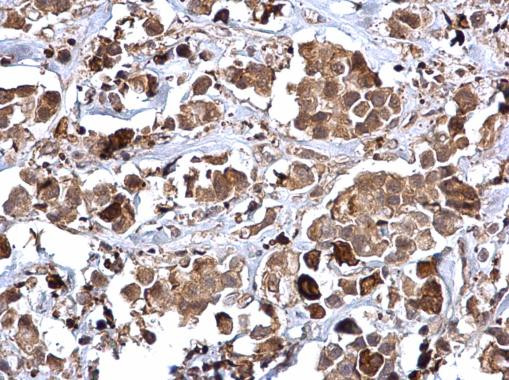 RAD51 Antibody in Immunohistochemistry (Paraffin) (IHC (P))