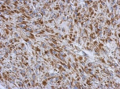 RNF212 Antibody in Immunohistochemistry (Paraffin) (IHC (P))