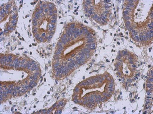 RAB39B Antibody in Immunohistochemistry (Paraffin) (IHC (P))