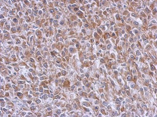 RAB39B Antibody in Immunohistochemistry (Paraffin) (IHC (P))