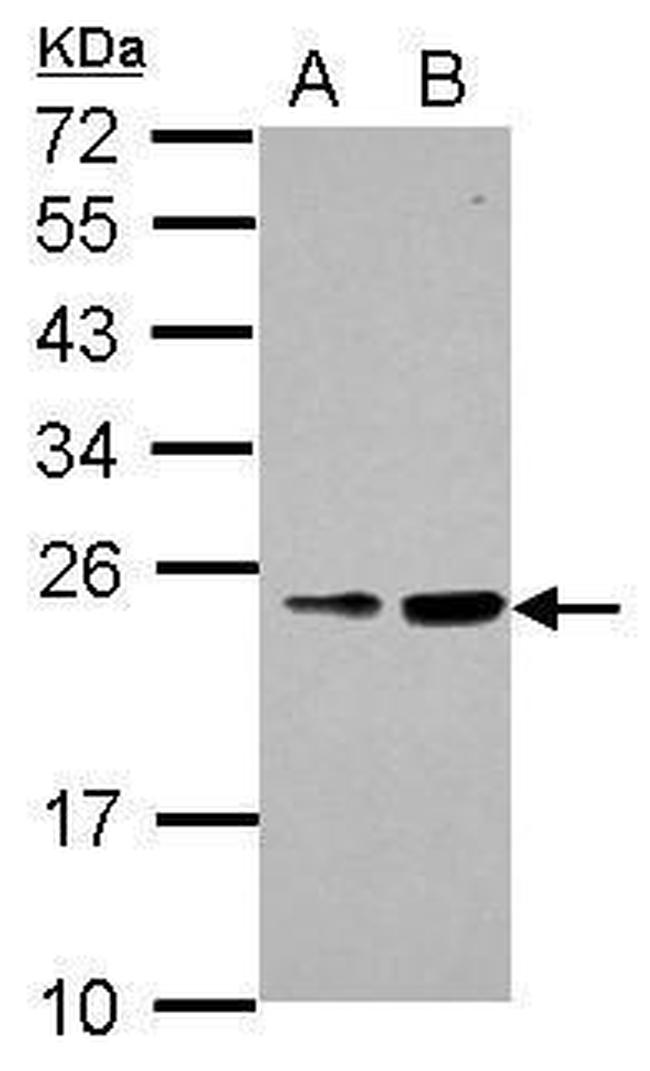 RAB39B Antibody in Western Blot (WB)