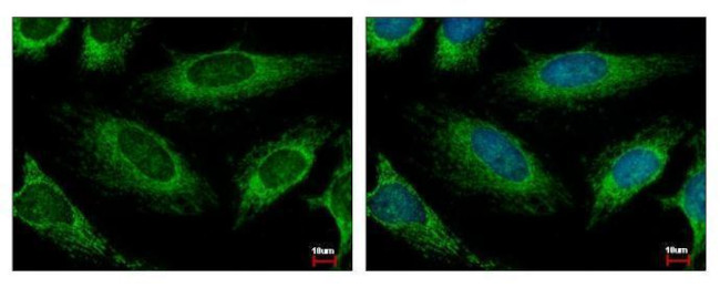 HADH Antibody in Immunocytochemistry (ICC/IF)