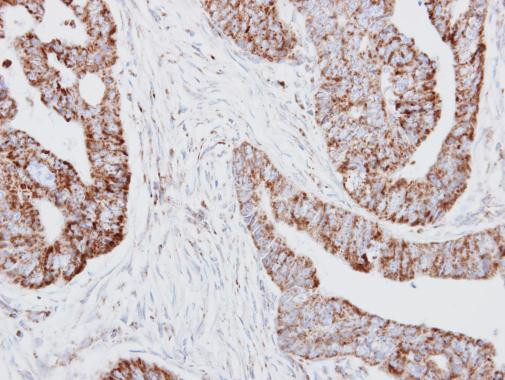 HADH Antibody in Immunohistochemistry (Paraffin) (IHC (P))