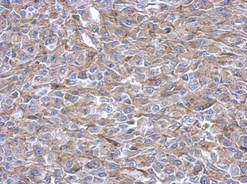 PAICS Antibody in Immunohistochemistry (Paraffin) (IHC (P))