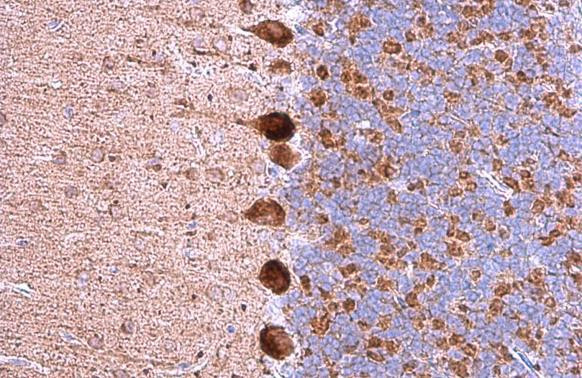 GABRA5 Antibody in Immunohistochemistry (Paraffin) (IHC (P))