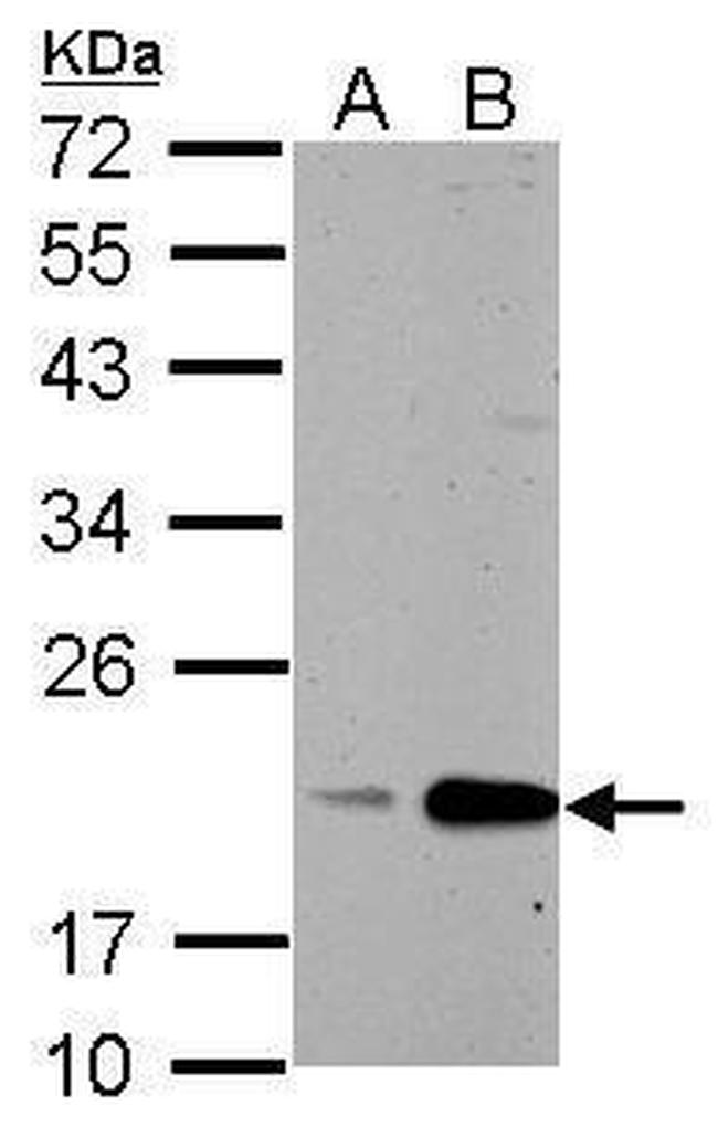 Cyclophilin B Antibody in Western Blot (WB)