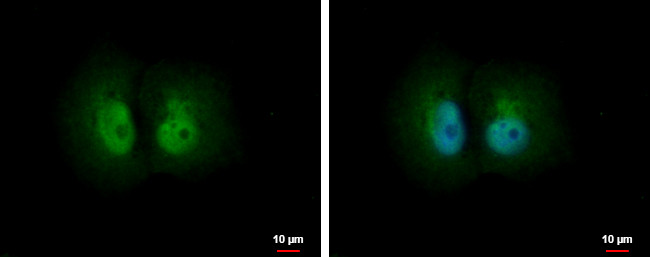 PSME1 Antibody in Immunocytochemistry (ICC/IF)