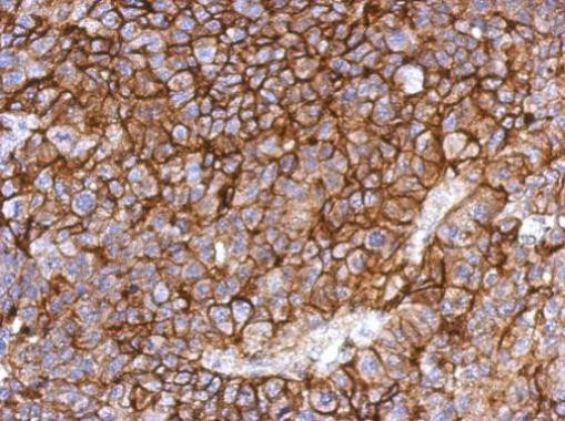 CAR Antibody in Immunohistochemistry (Paraffin) (IHC (P))