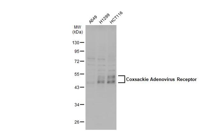 CAR Antibody in Western Blot (WB)