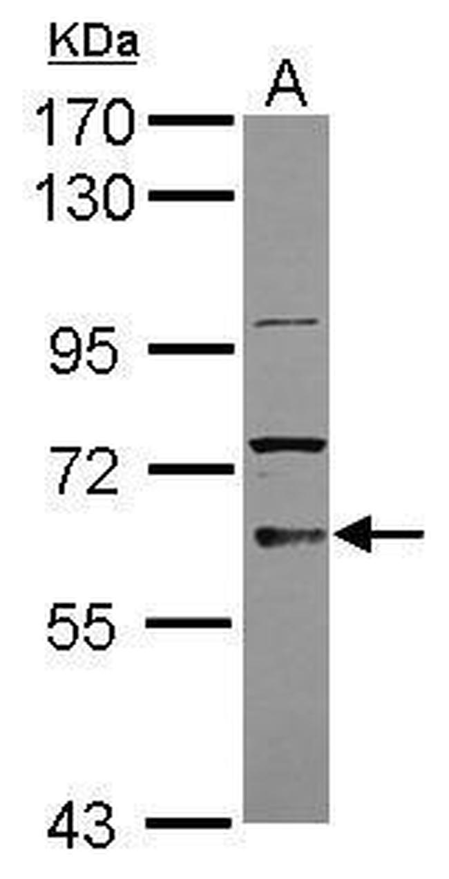 TKTL2 Antibody in Western Blot (WB)