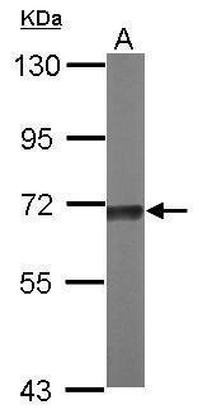 TKTL2 Antibody in Western Blot (WB)