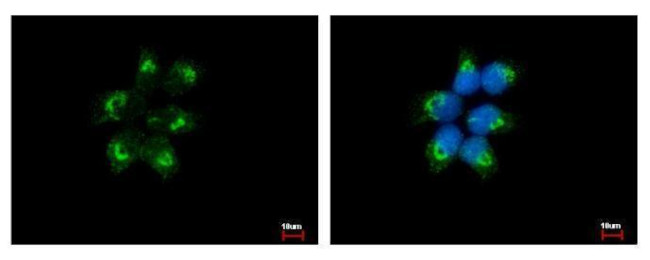 eIF1AY Antibody in Immunocytochemistry (ICC/IF)