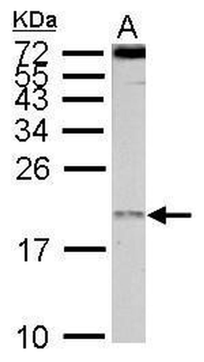 eIF1AY Antibody in Western Blot (WB)