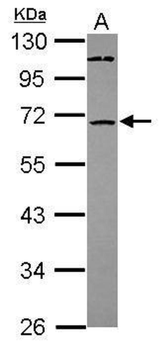 ST6GALNAC1 Antibody in Western Blot (WB)