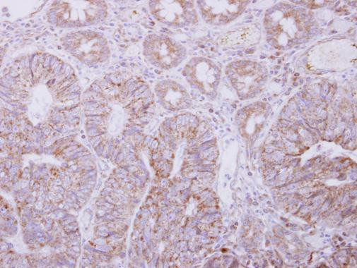 PIGO Antibody in Immunohistochemistry (Paraffin) (IHC (P))