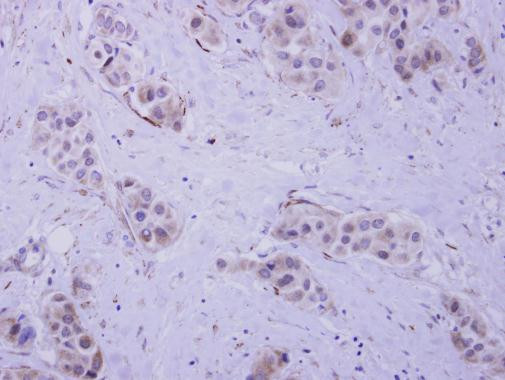 HIP55 Antibody in Immunohistochemistry (Paraffin) (IHC (P))