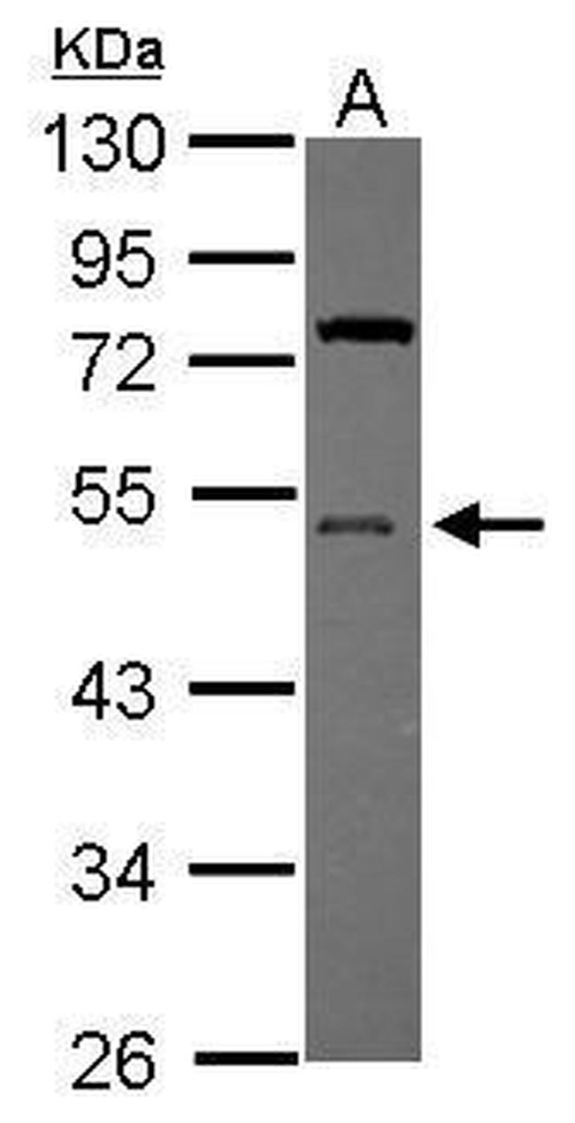 UBA5 Antibody in Western Blot (WB)